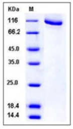 Human GRK2 protein, GST and Hi