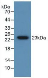 Human Gremlin 1 protein, His t