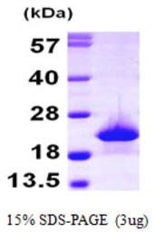 Human Myoglobin protein, His t