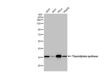 Thymidylate synthase antibody 