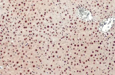 Glucocorticoid Receptor antibo