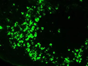 Mouse Anti-Human lambda light 