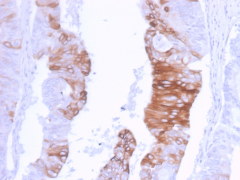 Cytokeratin 20 antibody [KRT20