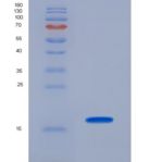 小鼠血小板衍生生长因子AA(PDGFAA)重组蛋白