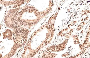 GADD153 antibody [HL2262]