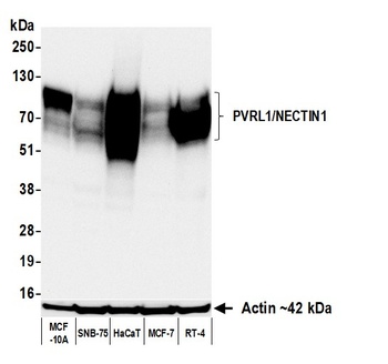 PVRL1/NECTIN1 Antibody 抗体，orb1