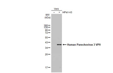 Human Parechovirus 1+3 VP0 ant