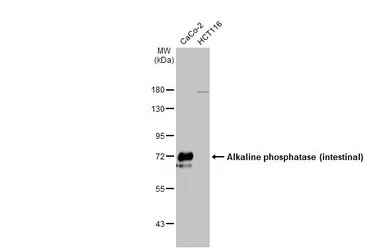 Alkaline phosphatase (intestin