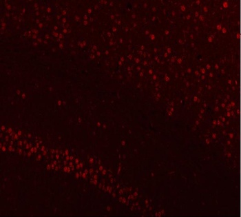 Anti-NUCKS1 Antibody 抗体，orb178