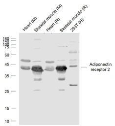 Adiponectin Receptor 2 antibod