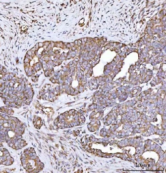 Anti-MECR Antibody 抗体，orb17437