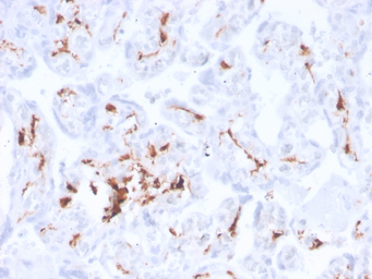 Factor XIIIa antibody [F13A1/3