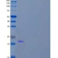 人锌指蛋白1(ZNHIT1)重组蛋白