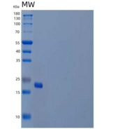 人胎盘催乳素/CSH1重组蛋白C-6His
