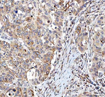 Anti-L3MBTL3 Antibody 抗体，orb17
