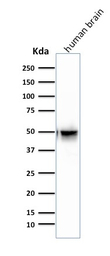 GFAP antibody [SPM507]