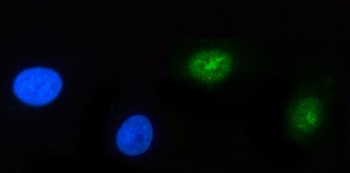 POLR3GL Antibody 抗体，orb1728148