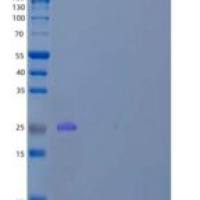 人含V-Set和跨膜结构域的2A/VSTM2A重组蛋白C-6His