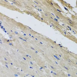 Ferrochelatase antibody