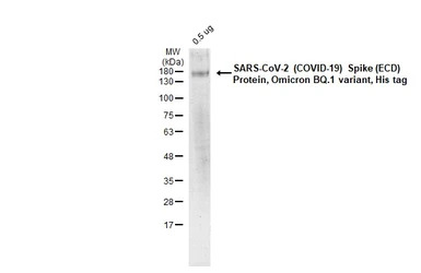 SARS-CoV-2 (COVID-19) Spike (E