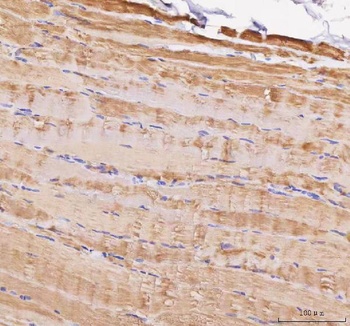 Anti-MYL5 Antibody 抗体，orb17860