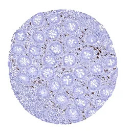 Factor XIIIa antibody [MSVA-81