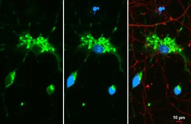 Myelin basic protein antibody 