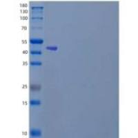 人锌指蛋白70(ZNF70)重组蛋白N-6His