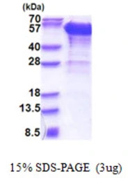 Human DCTN2 protein, His tag