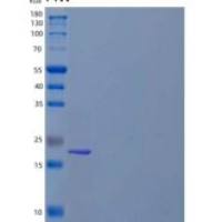 小鼠干细胞因子/SCF/c-Kit配体重组蛋白
