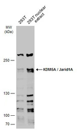 KDM5A / Jarid1A / RBBP2 antibo