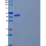 人妊娠特异性β1-糖蛋白(PSG1)重组蛋白C-6His