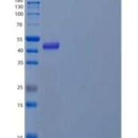 人妊娠特异性β1-糖蛋白(PSG1)重组蛋白C-6His