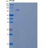 人肝配蛋白B受体1(EPHB1)重组蛋白C-Fc
