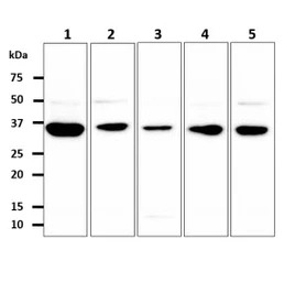 GPD1L antibody [AT14E2]