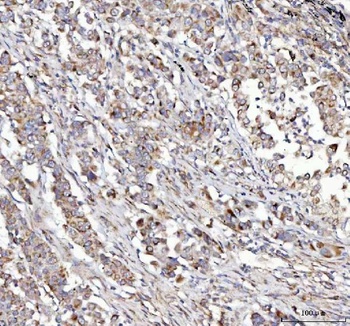 Anti-NUBPL Antibody 抗体，orb1786