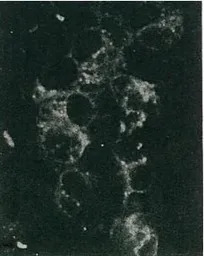 Hepatitis C virus NS5 protein 