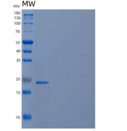 人磷酸甲羟戊酸激酶/PMVK重组蛋白N-6His