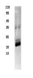 Human RAC3 protein, His tag