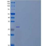 人激肽释放酶6(KLK6)重组蛋白