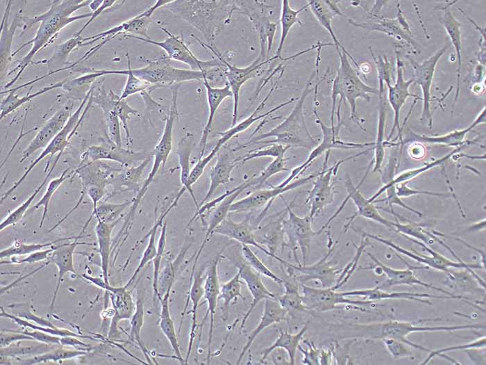 人胰腺肿瘤成纤维细胞(永生化)图片