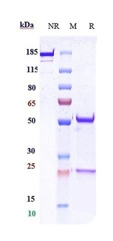 Anti-CDH1 / E-cadherin / CD324