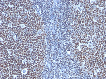 Cyclin B1 antibody [SPM619]