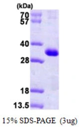 Human CSEN protein, His tag