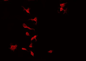 TIE2 (phospho Ser1119) antibod