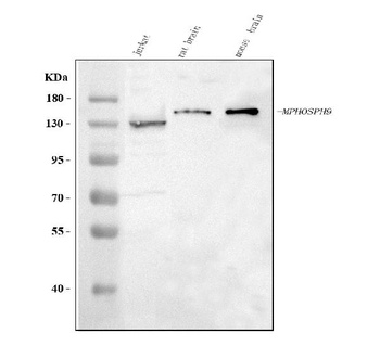 Anti-MPHOSPH9 Antibody 抗体，orb1