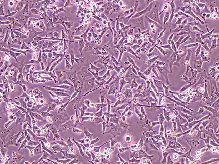 NCI-H446细胞图片