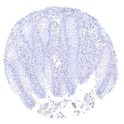 PAPP A antibody [MSVA-780M] Hi