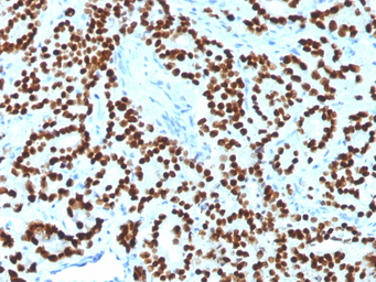 FOXA1 antibody [FOXA1/1518]