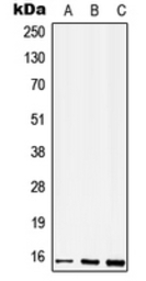 CD52 antibody